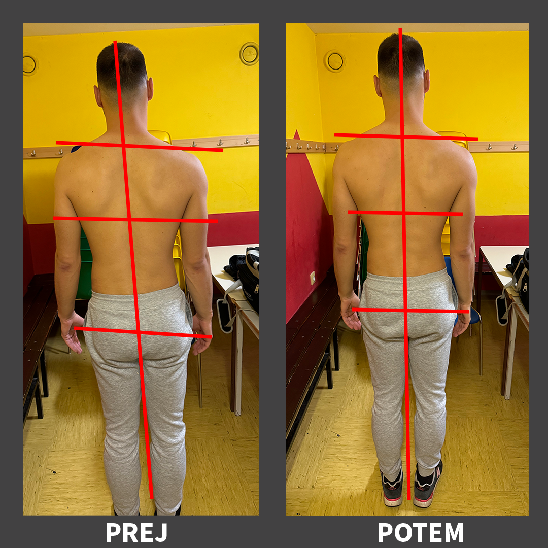 Posture Improvement - Male Client