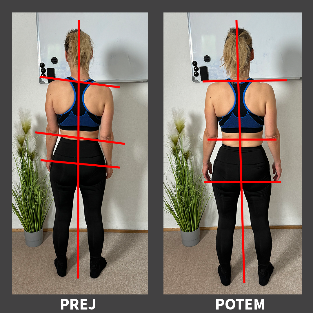 Posture Improvement - Female Client