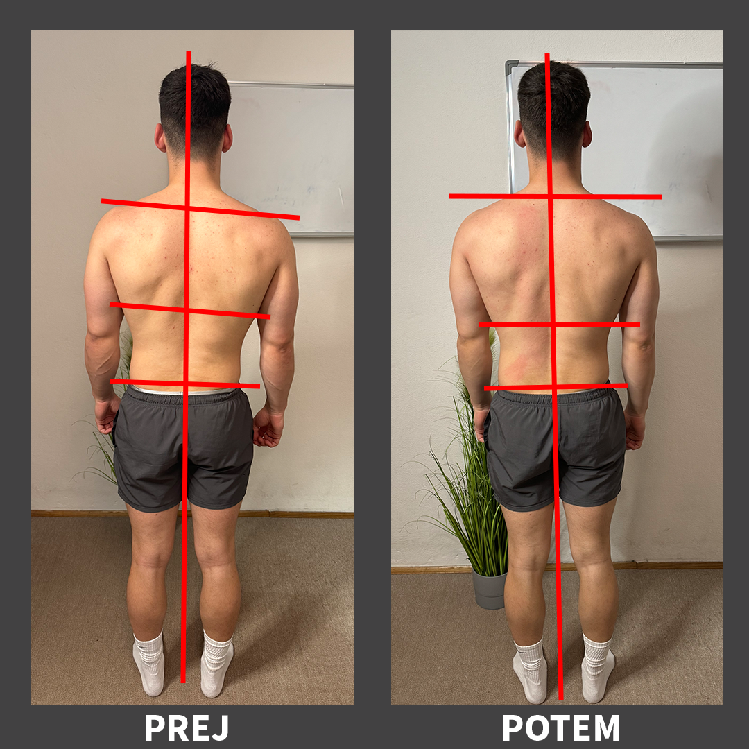 Posture Improvement - Male Client 2