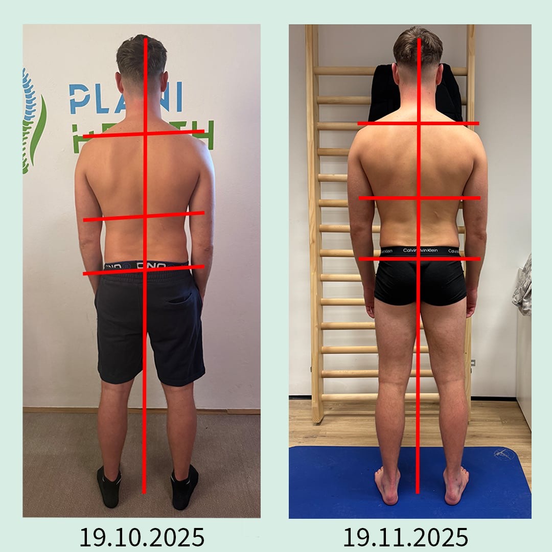 Posture Comparison Over Time